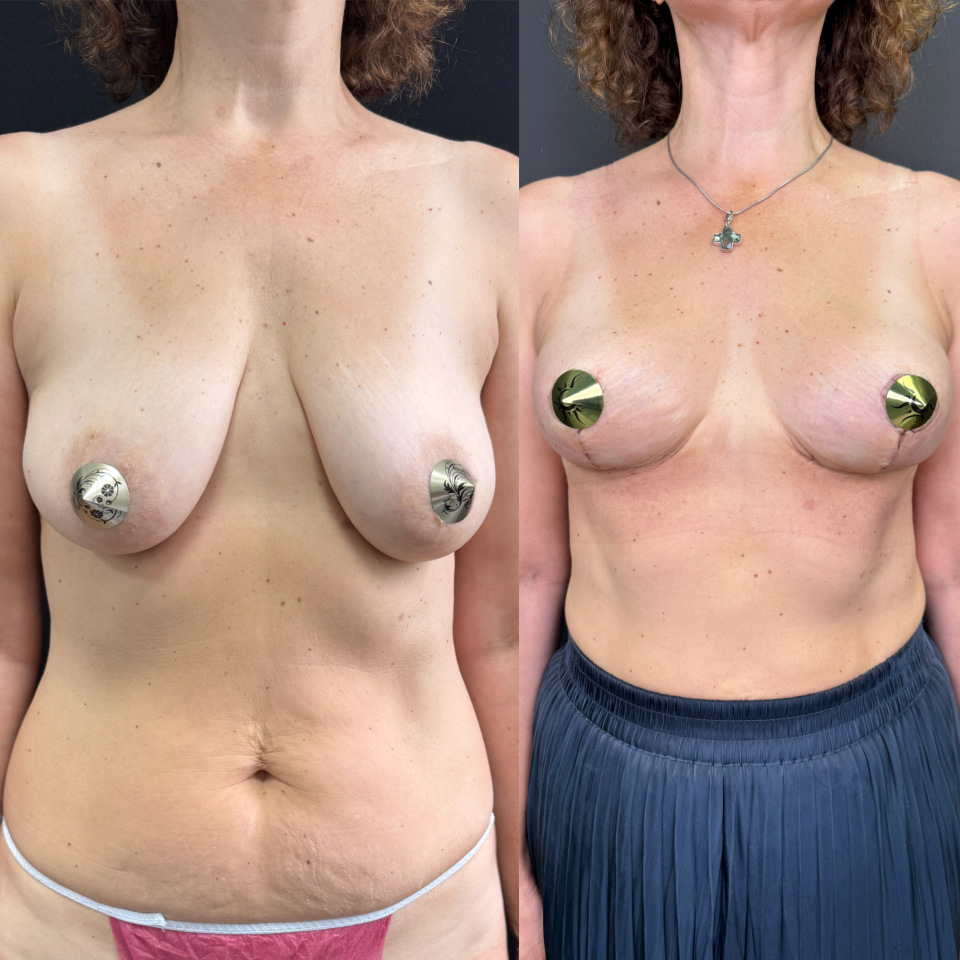3 недели , фотография 1 3 недели , фотография 1