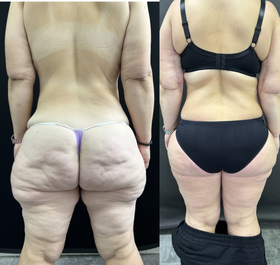 Комплексная операция . Фото до после , фотография 7