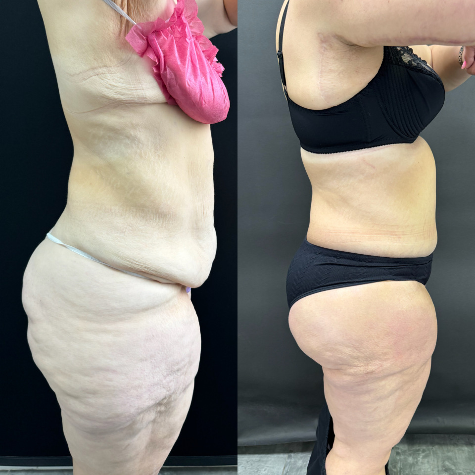 Комплексная операция . Фото до после , фотография 10