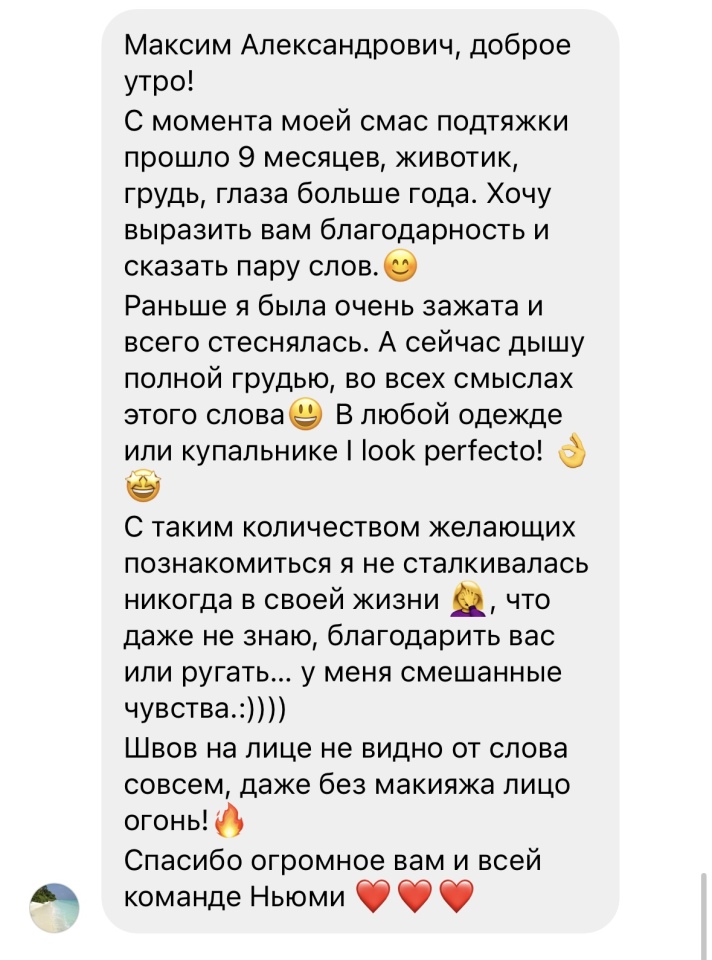 Читайте отзыв пациентки спустя 1,5 года после увеличения груди , абдоминопластики и смас подтяжки лица и шеи в сочетании с блефаропластикой верхних и нижних век , фотография 4